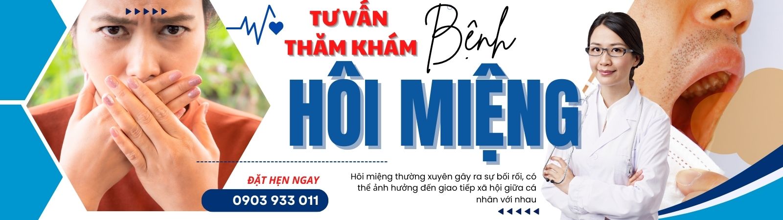 MS 16 GÓI KHÁM BỆNH HÔI MIỆNG